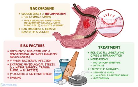 Acute Gastritis: Causes, Symptoms, and Diagnosis .